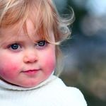Аллергия на смородину – причины появления и симптомы у взрослых и детей