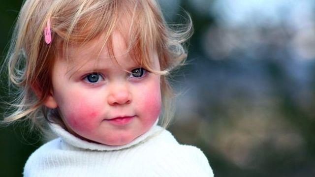 Аллергия на смородину – причины появления и симптомы у взрослых и детей